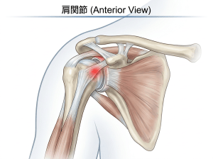 肩関節 (Anterior View) labeled shoulder anatomy diagram: 肩峰, 烏口突起, 鎖骨, 上腕骨頭, 上腕骨, 棘上筋, 棘下筋, 小円筋, 肩甲骨, 肩甲下筋, 関節包, 棘上腱